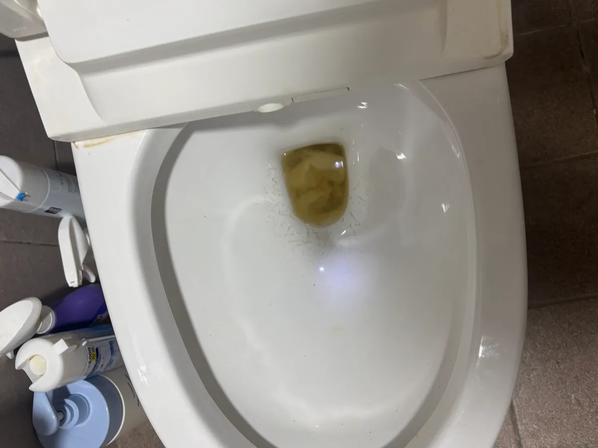 안양시 동안구 변기 막힘 비용, 양쪽 변기 역류와 공용관 휴지 막힘